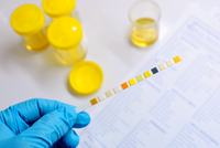 Six Things Your Pee Can Tell You